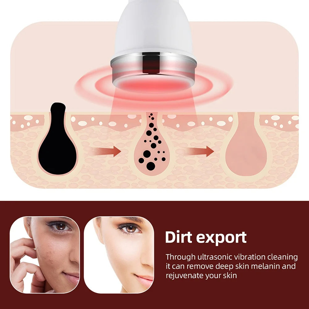 Ultraschall Hautpflege Schönheit Maschine Hochfrequenz Gesicht Auge Massagegerät Facelifting Gesichts Sauber SPA Ultraschall Schönheit Gerät