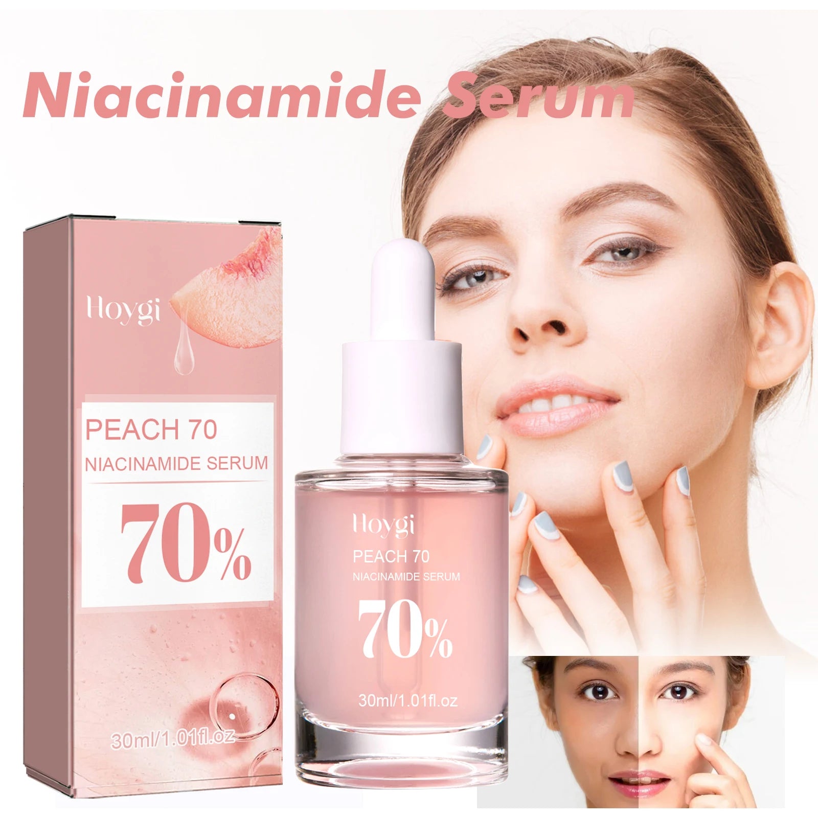 Niacinamide Serum 70% – Poren verfeinern, Hautbild vereinheitlichen | 30ml