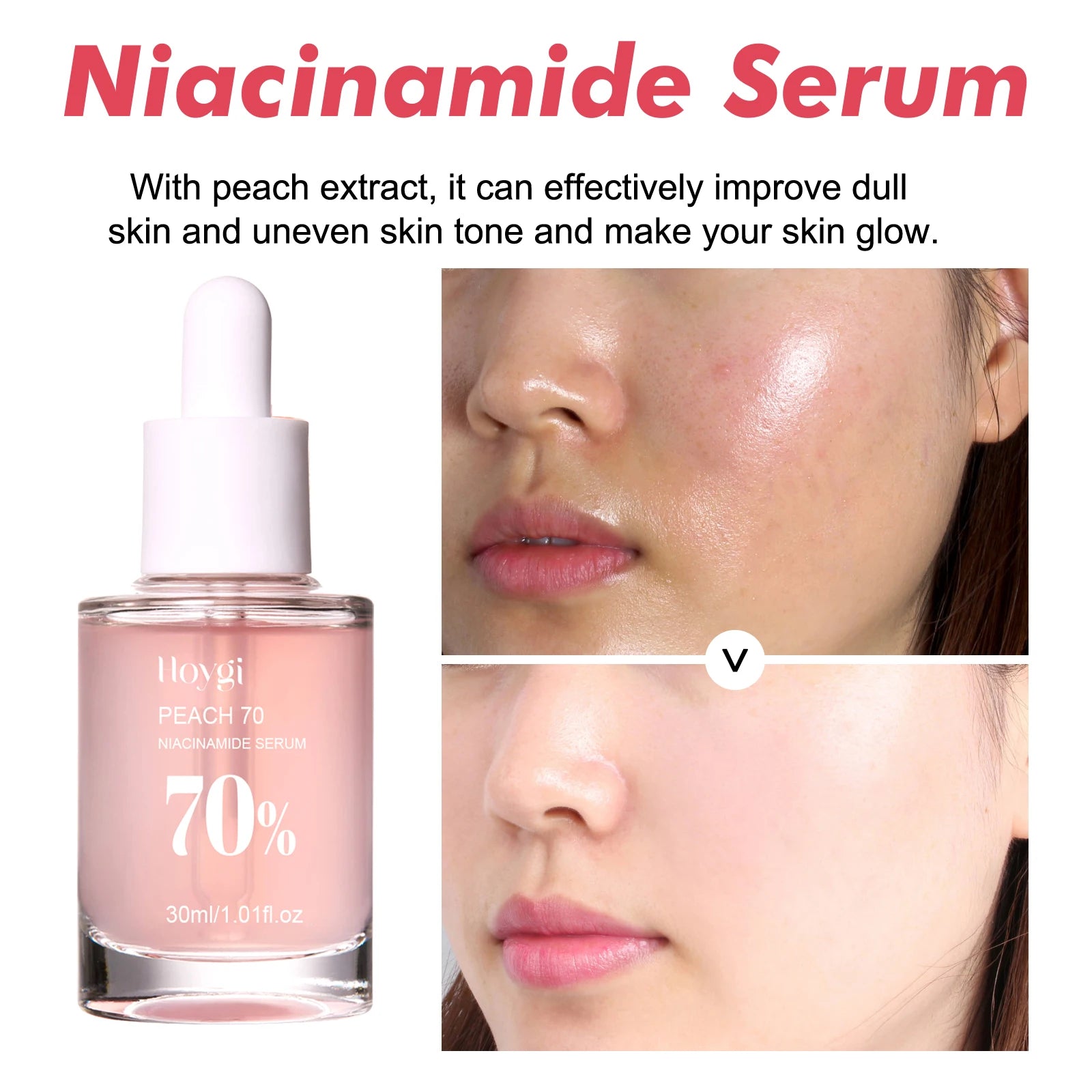 Niacinamide Serum 70% – Poren verfeinern, Hautbild vereinheitlichen | 30ml