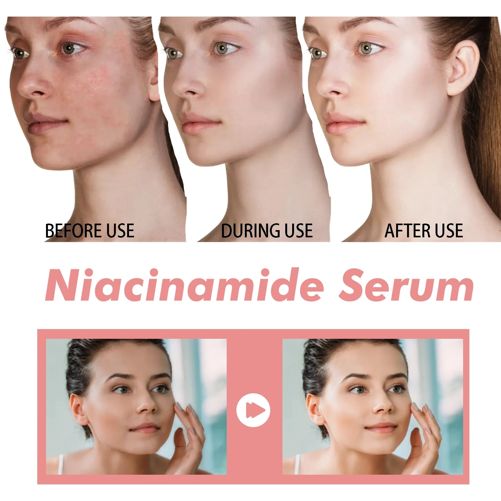 Niacinamide Serum 70% – Poren verfeinern, Hautbild vereinheitlichen | 30ml